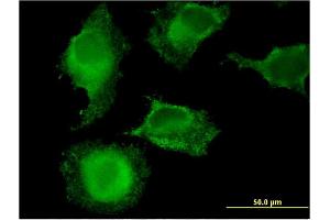 Immunofluorescence of monoclonal antibody to MARCH9 on HeLa cell.