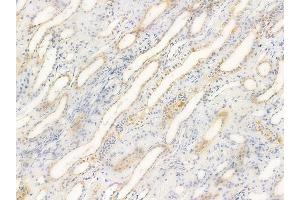 ABIN6260836 and ABIN6266727 at 1/100 staining human normal kidney tissue by IHC-P. (CIB2 anticorps  (Internal Region))
