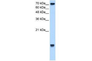 WB Suggested Anti-UBE2N Antibody Titration:  2.