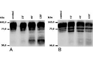 Western blotting analysis of PMA-activated neutrophils (A) and monocytes (B), using anti-human CD18 (MEM-148). (Integrin beta 2 anticorps)