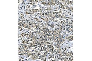 IHC analysis of ASS1 using anti-ASS1 antibody (ABIN7601191).