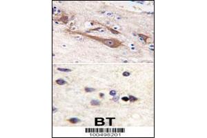 Formalin-fixed and paraffin-embedded human brain tissue reacted with VILIP1 antibody (C-term ), which was peroxidase-conjugated to the secondary antibody, followed by DAB staining. (VSNL1 anticorps  (C-Term))