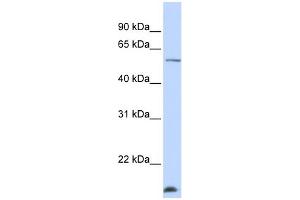 WB Suggested Anti-WDR40A Antibody Titration:  0. (DCAF12 anticorps  (N-Term))