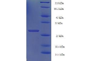 SDS-PAGE (SDS) image for Histone H2B Type 1-N (HIST1H2BN) (AA 2-126) protein (His-SUMO Tag) (ABIN5711721)