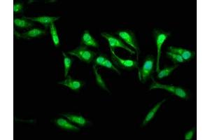 Immunofluorescence staining of Hela cells with ABIN7165980 at 1:133, counter-stained with DAPI. (SSH3 anticorps  (AA 480-659))