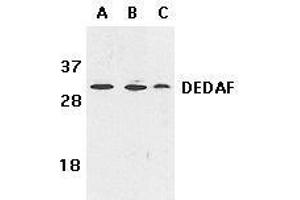 Immunohistochemical staining of DEDAF in mouse liver tissue with DEDAF antibody at 10μg/ml. (RYBP anticorps)