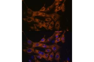 Immunofluorescence analysis of NIH-3T3 cells using Fatty Acid Synthase (FASN) Rabbit mAb  at dilution of 1:100 (40x lens).