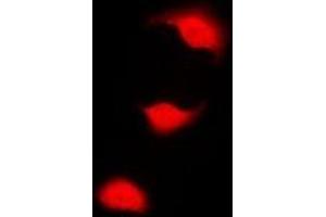 Immunofluorescent analysis of CHK1 (pS301) staining in HeLa cells. (CHEK1 anticorps  (pSer301))