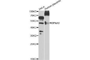 Western blot analysis of extracts of various cell lines, using DFNA5 Antibody. (DFNA5 anticorps)