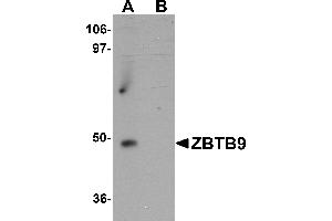 Western Blotting (WB) image for anti-Zinc Finger and BTB Domain Containing 9 (ZBTB9) (C-Term) antibody (ABIN1030815) (ZBTB9 anticorps  (C-Term))