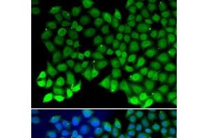 Immunofluorescence analysis of MCF-7 cells using RPA1 Polyclonal Antibody (RPA1 anticorps)