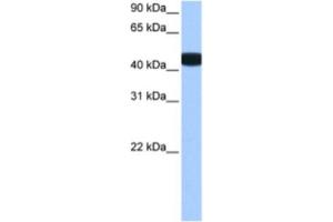 Western Blotting (WB) image for anti-Branched Chain Ketoacid Dehydrogenase Kinase (BCKDK) antibody (ABIN2463496) (BCKDK anticorps)