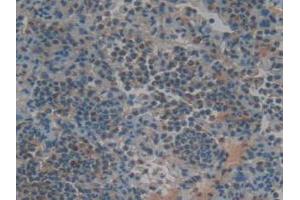 IHC-P analysis of Rat Lung Tissue, with DAB staining. (TNFRSF11A anticorps  (AA 31-214))