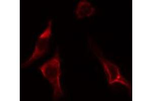 ABIN6274551 staining LOVO cells by IF/ICC.