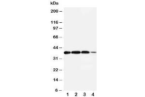 Western blot testing of Arg2 antibody and Lane 1:  rat lung