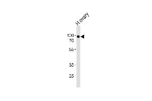 Western blot analysis of lysate from human ovary tissue, using ENG Antibody (Center) (ABIN6242846 and ABIN6577838).