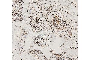 IHC analysis of HLA-DRA using anti-HLA-DRA antibody (ABIN7600948). (HLA-DRA anticorps  (AA 26-254))