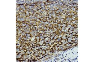 Immunohistochemistry of paraffin-embedded human tonsil using CD11b/ITGAM antibody (ABIN3022179, ABIN3022180, ABIN3022181 and ABIN6218650) at dilution of 1:100 (40x lens).