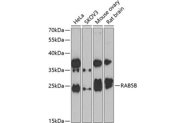 RAB5B Antikörper  (AA 1-215)