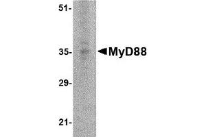 Western Blotting (WB) image for anti-Myeloid Differentiation Primary Response Gene (88) (MYD88) antibody (ABIN1031779) (MYD88 anticorps)