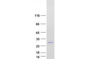 Validation with Western Blot