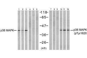 Western blot analysis of extracts from NIH-3T3 (Line 1, 4, 7 and 10) and COS7 (Line 2, 5, 8 and 11 and K562 (Line 3, 6, 9 and 12) cells, untreated or treated with (MAPK14 anticorps)