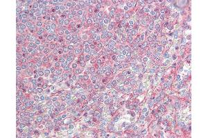 Human Spleen: Formalin-Fixed, Paraffin-Embedded (FFPE) (MTCL1 / SOGA2 anticorps  (AA 13-202))