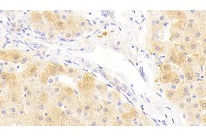 Detection of SAA2 in Human Liver Tissue using Polyclonal Antibody to Serum Amyloid A2 (SAA2) (SAA2 anticorps  (AA 19-122))