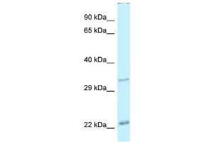 WB Suggested Anti-Pdx1 Antibody Titration: 1. (PDX1 anticorps  (N-Term))