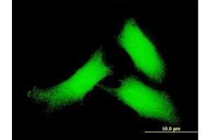 anti-Calcium/calmodulin-Dependent Protein Kinase II delta (CAMK2D) (AA 301-410) antibody