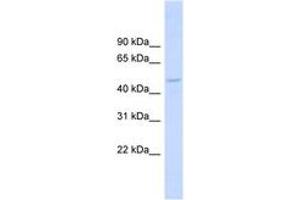 Image no. 1 for anti-Drebrin-Like (DBNL) (AA 251-300) antibody (ABIN6743772) (DBNL anticorps  (AA 251-300))