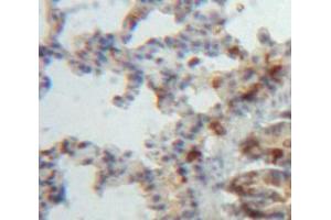 Used in DAB staining on fromalin fixed paraffin-embedded Lung tissue (ADAMTS8 anticorps  (AA 832-889))