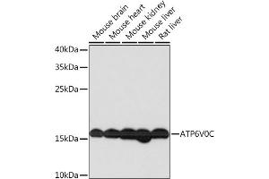 Western blot analysis of extracts of various cell lines, using V0C Rabbit pAb  at 1:1000 dilution.