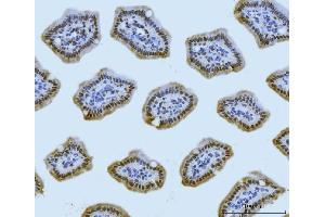 IHC analysis of MRE11 using anti-MRE11 antibody (ABIN7600025). (Mre11 anticorps  (AA 14-481))
