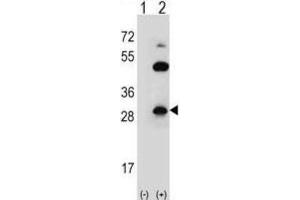 Western Blotting (WB) image for anti-Claudin 2 (CLDN2) antibody (ABIN2996861) (Claudin 2 anticorps)