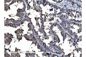 IHC analysis of DYNLL1/PIN using anti-DYNLL1/PIN antibody (ABIN7599571).