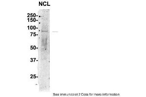 Sample Type: 1. (Nucleolin anticorps  (C-Term))