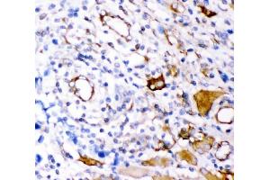 IHC analysis of Plectin using anti-Plectin antibody (ABIN3043900). (PLEC anticorps  (Middle Region))