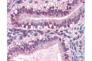 Anti-CRABP2 antibody IHC of human uterus. (CRABP2 anticorps  (AA 1-138))