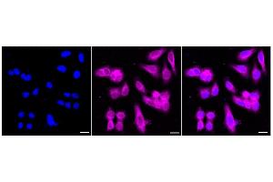 Immunocytochemical staining of HepG2 cells with PPP2R5E antibody (ABIN7800024), 1:1,000).