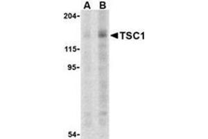 Western blot analysis of TSC1 in C2C12 cell lysate with this product at (A) 2 and (B) 4 μg. (TSC1 anticorps  (C-Term))