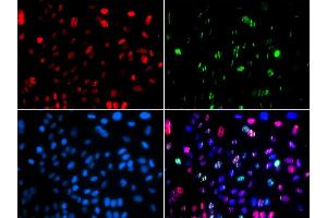 Immunofluorescence (IF) image for anti-Tumor Protein P53 (TP53) (pSer15) antibody (ABIN3023601) (p53 anticorps  (pSer15))