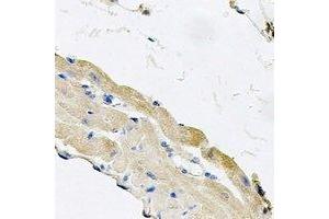 Immunohistochemical analysis of Cytochrome P450 2F1 staining in mouse lung formalin fixed paraffin embedded tissue section. (CYP2F1 anticorps)