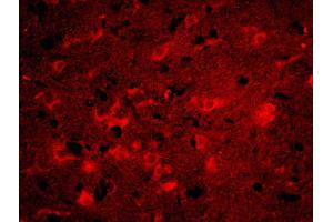 Formalin-fixed and paraffin-embedded rat brain labeled with Anti-ITM2A Polyclonal Antibody, Unconjugatedused at 1:200 dilution for 40 minutes at 37°C. (ITM2A anticorps  (AA 73-123))