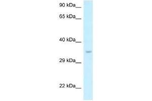 Western Blot showing Six1 antibody used at a concentration of 1. (SIX Homeobox 1 anticorps  (N-Term))