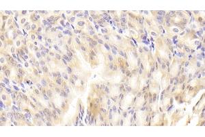 Detection of RBP2 in Mouse Stomach Tissue using Polyclonal Antibody to Retinol Binding Protein 2, Cellular (RBP2)