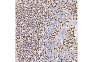 Immunohistochemistry of paraffin-embedded human tonsil using IKZF3 antibody (ABIN7267842) at dilution of 1:100 (40x lens). (IKZF3 anticorps)