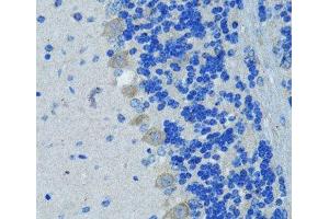 Immunohistochemistry of paraffin-embedded Mouse brain using Nestin Polyclonal Antibody at dilution of 1:100 (40x lens).