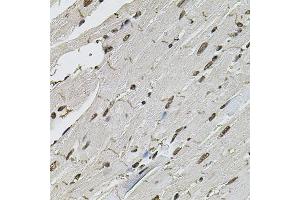 Immunohistochemistry of paraffin-embedded mouse heart using CTNNB1 antibody (ABIN4903403) at dilution of 1:100 (40x lens). (CTNNB1 anticorps)