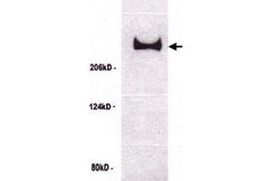 Western blot analysis of TP53BP1 in untreated U-2 OS cell lysate with TP53BP1 polyclonal antibody . (TP53BP1 anticorps)